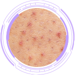 Lông mọc ngược