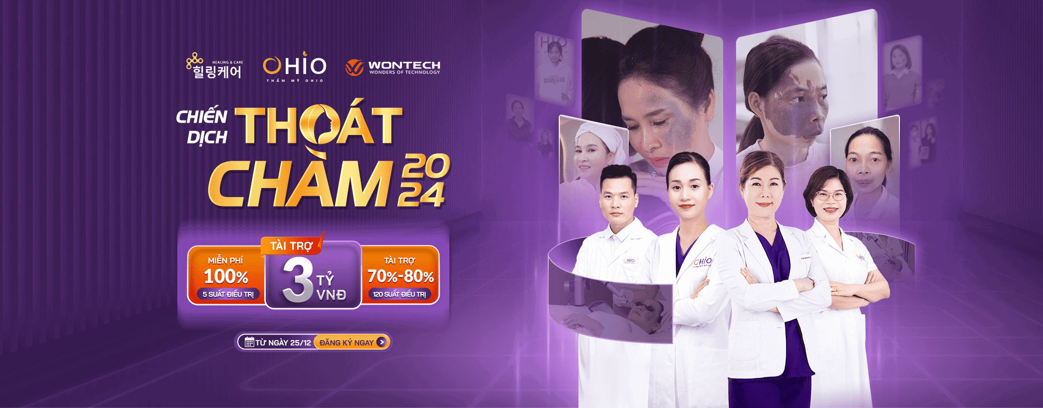 Chiến dịch Thoát Chàm 2024 tài trợ xoá chàm miễn phí 3 tỷ đồng