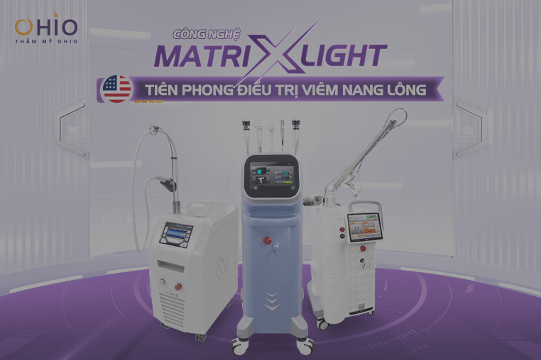 công nghệ matri xlight