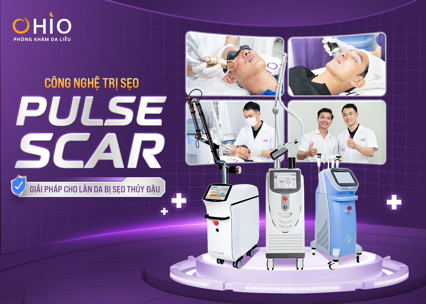 Điều trị sẹo thủy đậu hiệu quả cao