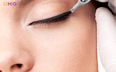 Địa chỉ xóa xăm mí mắt ở Hà Nội uy tín, chất lượng