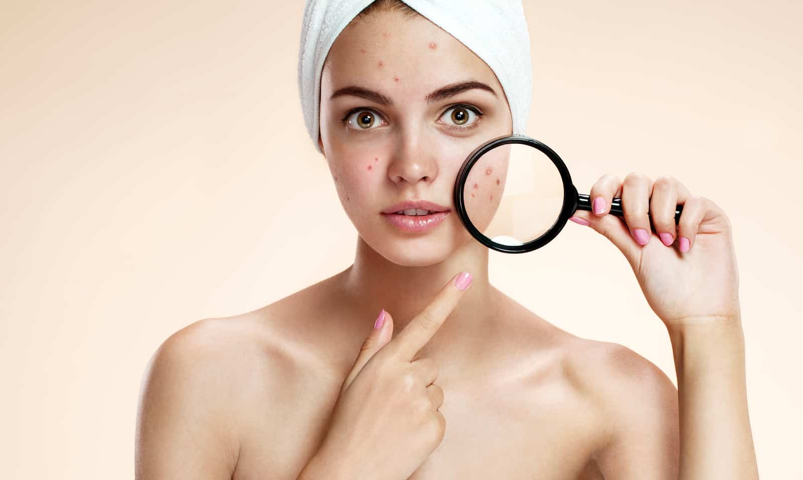 7 điều cần biết để trị mụn hiệu quả