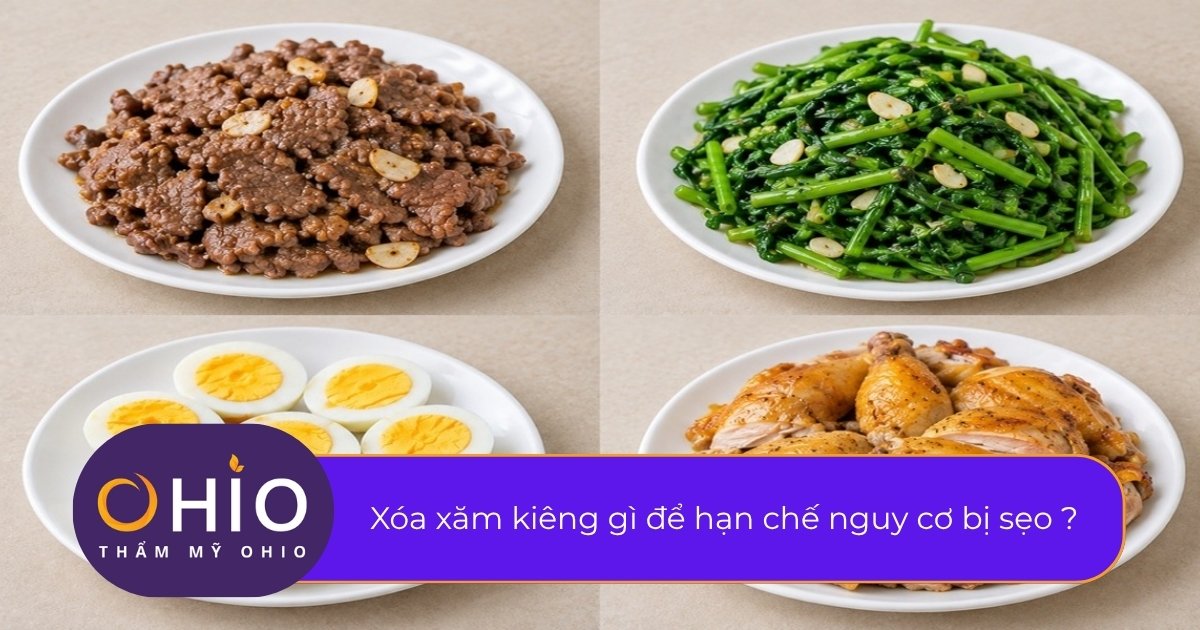 Xóa xăm kiêng gì để hạn chế nguy cơ bị sẹo ?