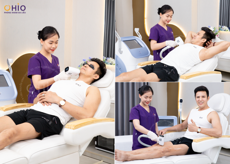 Xóa sạch các vùng lông rậm, cứng với địa chỉ triệt lông tốt ở Hà Nội dành cho nam