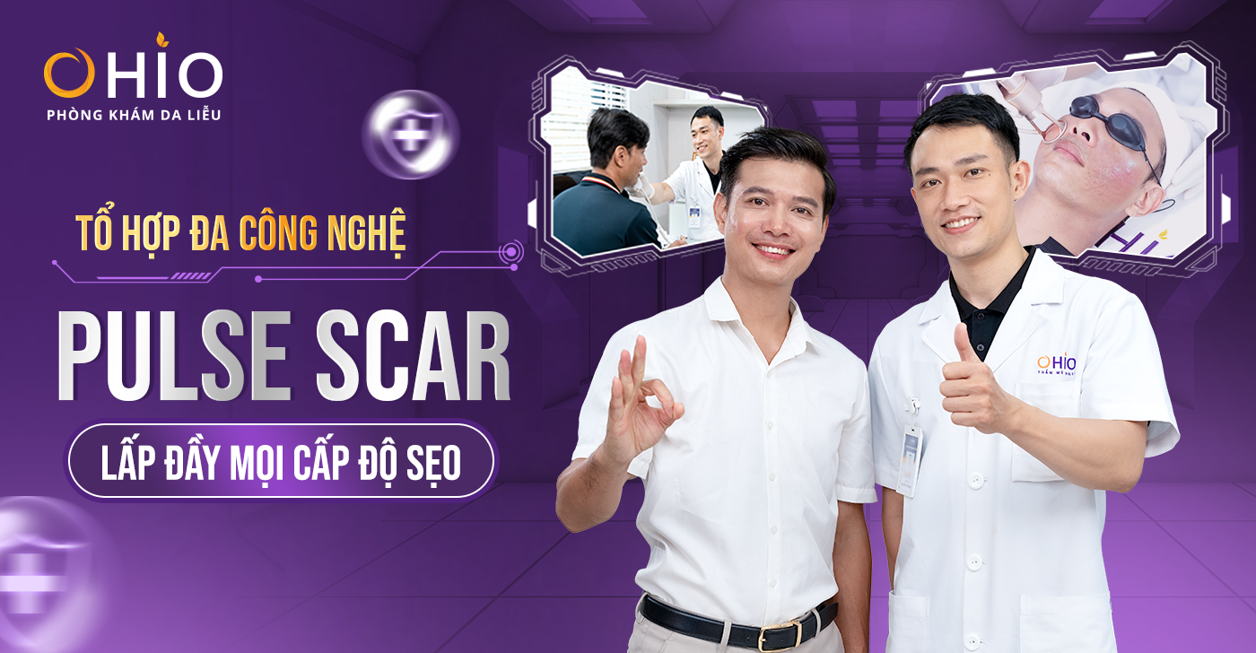 Trị sẹo rỗ bằng Tổ hợp đa công nghệ Pulse Scar – Lấp đầy mọi cấp độ sẹo, da trắng sáng mịn màng