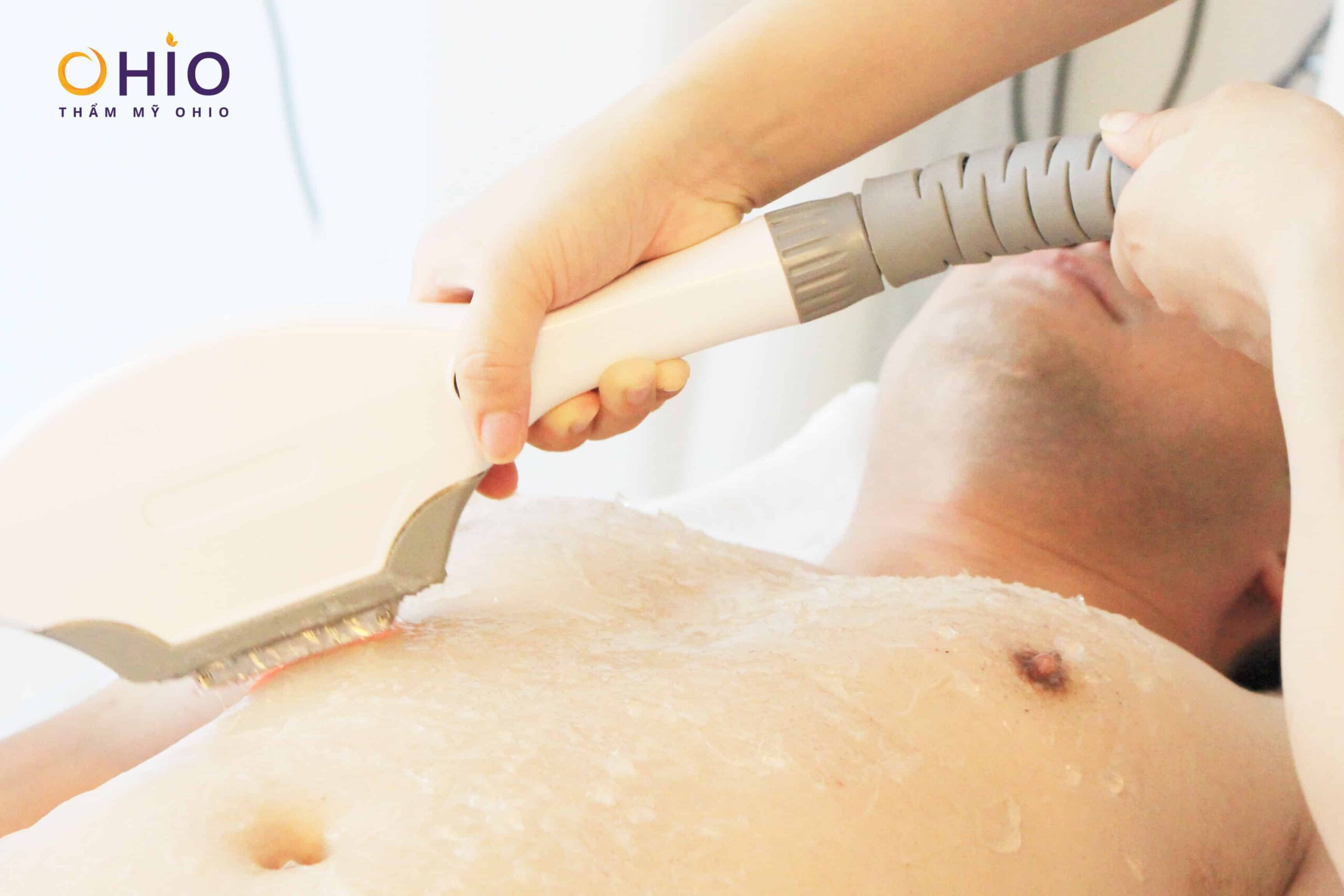 Diode Laser M3 – công nghệ triệt lông chuyên sâu đầu tiên dành cho nam giới!