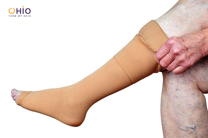 Trị giãn mao mạch bằng vớ y khoa có hiệu quả không?