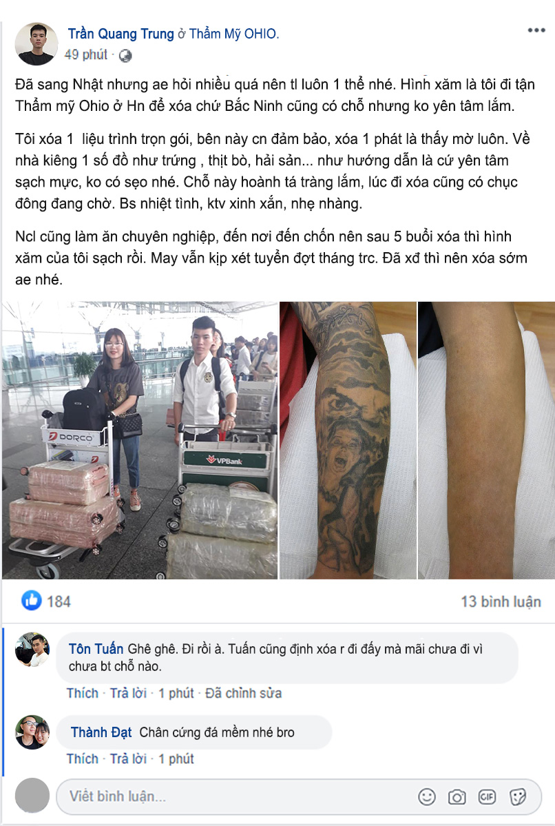 Review thực tế của khách hàng điều trị laser tại Thẩm mỹ OHIO