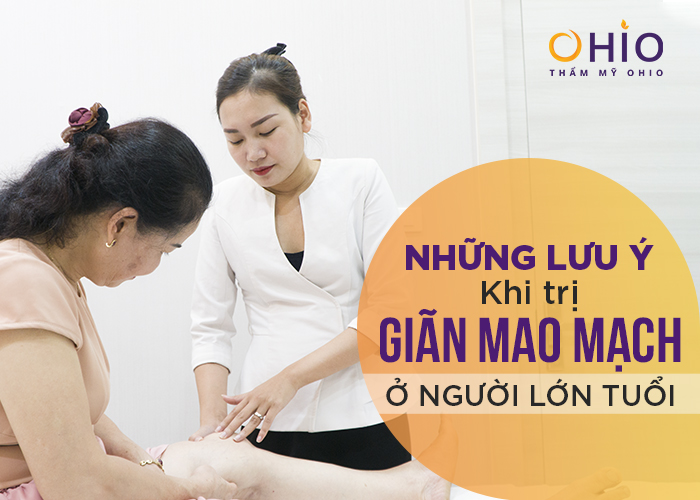 Những lưu ý quan trọng khi trị giãn mao mạch ở người lớn tuổi