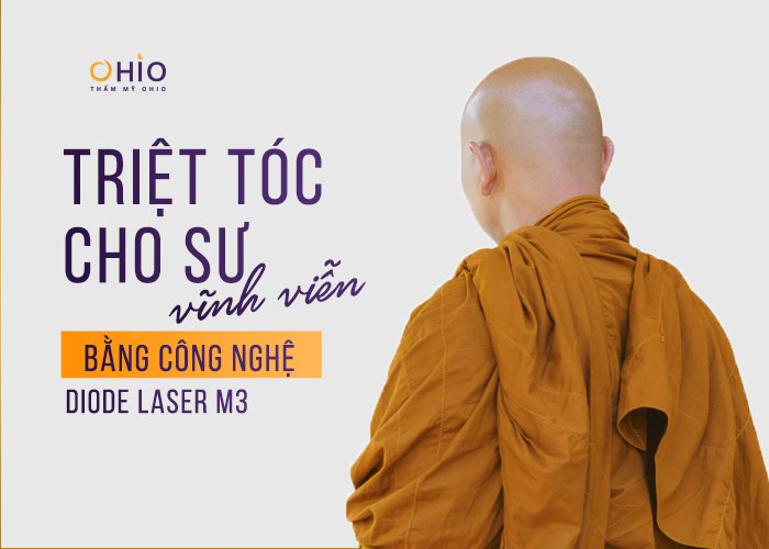 Triệt tóc cho sư bằng công nghệ Laser Diode M3 - Phòng khám da liễu OHIO Triệt tóc cho sư bằng công nghệ Laser Diode M3
