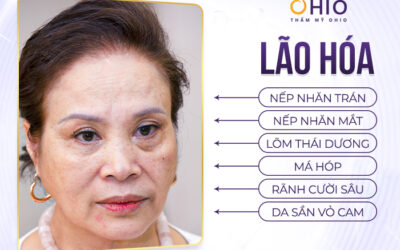 Trẻ hóa, xóa nhăn bằng Meso / HA / BAP