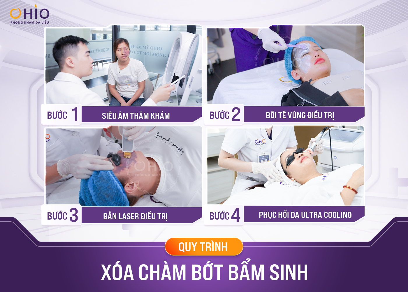 [Bật mí] Cách xóa vết bớt bẩm sinh hiệu quả, không đau đớn