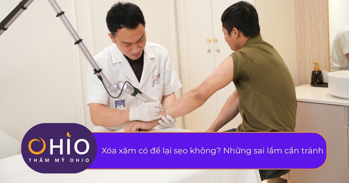 Xóa xăm có để lại sẹo không? Những sai lầm cần tránh