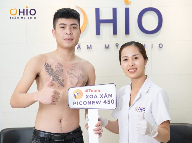 Anh Quốc Khánh chia sẻ kết quả xóa xăm mãnh hổ với Piconew 450
