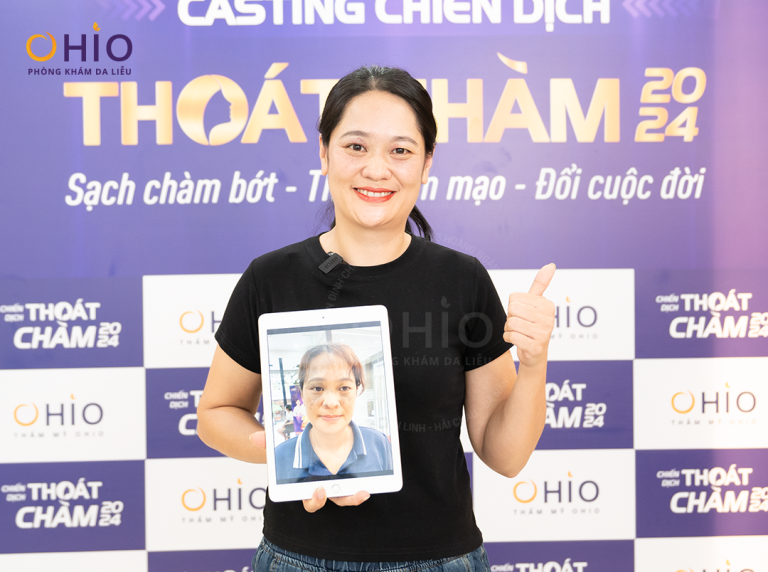 Chị Ngọc Liên hạnh phúc cùng gia đình sau xóa sạch chàm tại OHIO