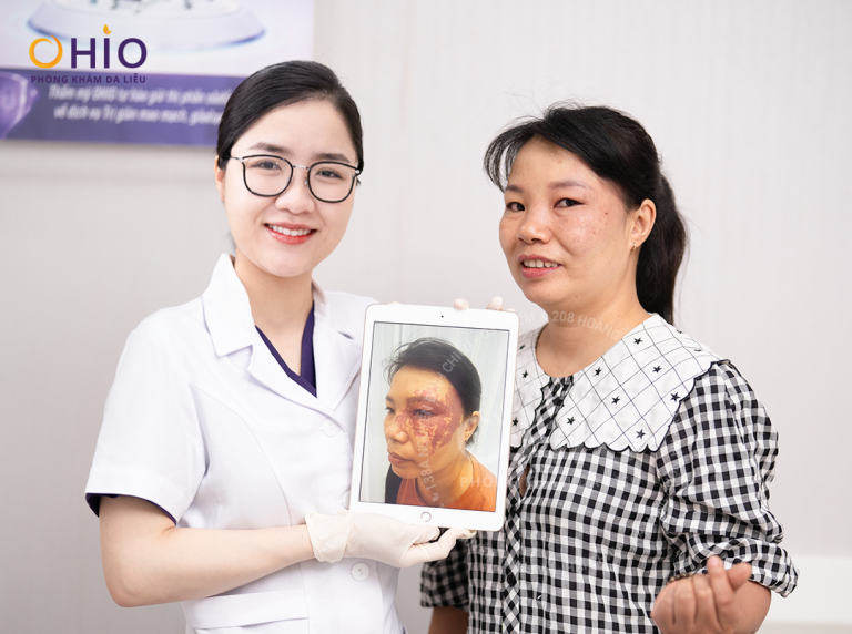 Chị Kim Huệ sạch chàm bớt thay diện mạo, đổi cuộc đời
