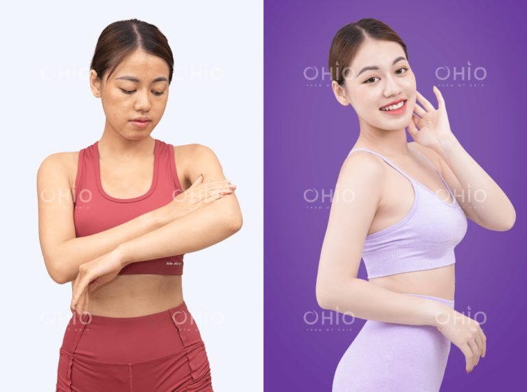 Chị Mai Trang da trắng mịn rõ rệt sau tắm trắng Natural White