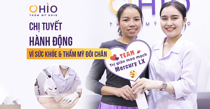 Chị Tuyết (Lạng Sơn) trị giãn mao mạch vì sức khỏe & thẩm mỹ đôi chân