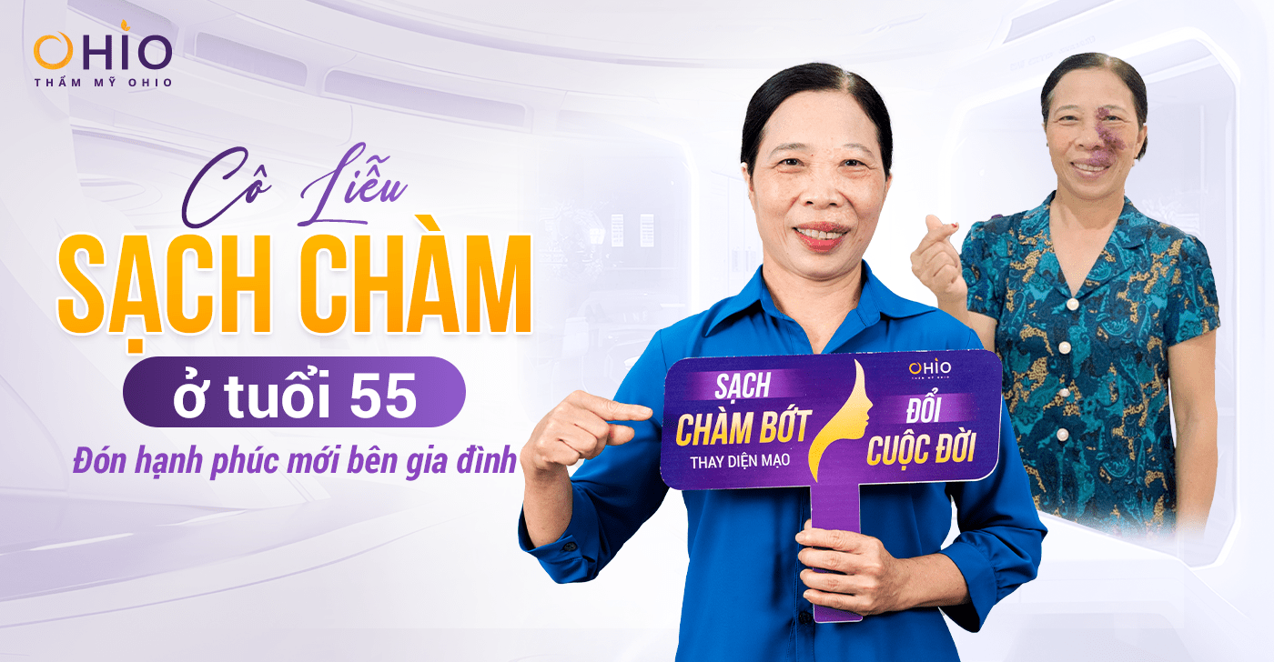 Cô Cao Thị Liễu: Hành trình xóa sạch chàm bớt đỏ ở tuổi 55 tại OHIO