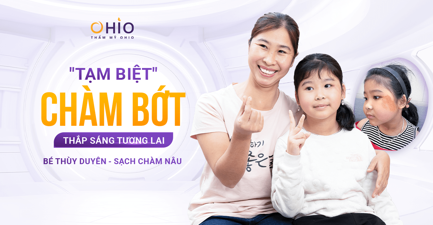 Hành trình xóa chàm thành công của bé Thùy Duyên tại OHIO