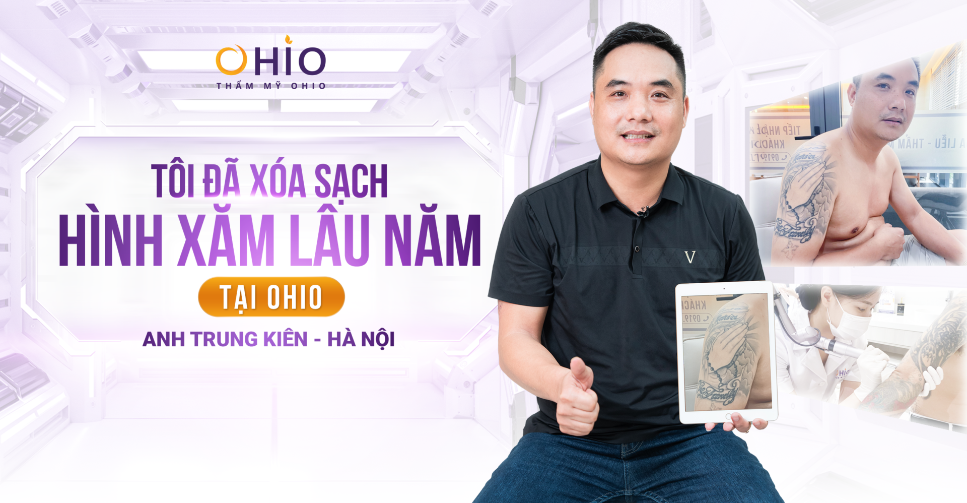 Anh Trung Kiên: Tôi đã xóa sạch hình xăm lâu năm tại OHIO!