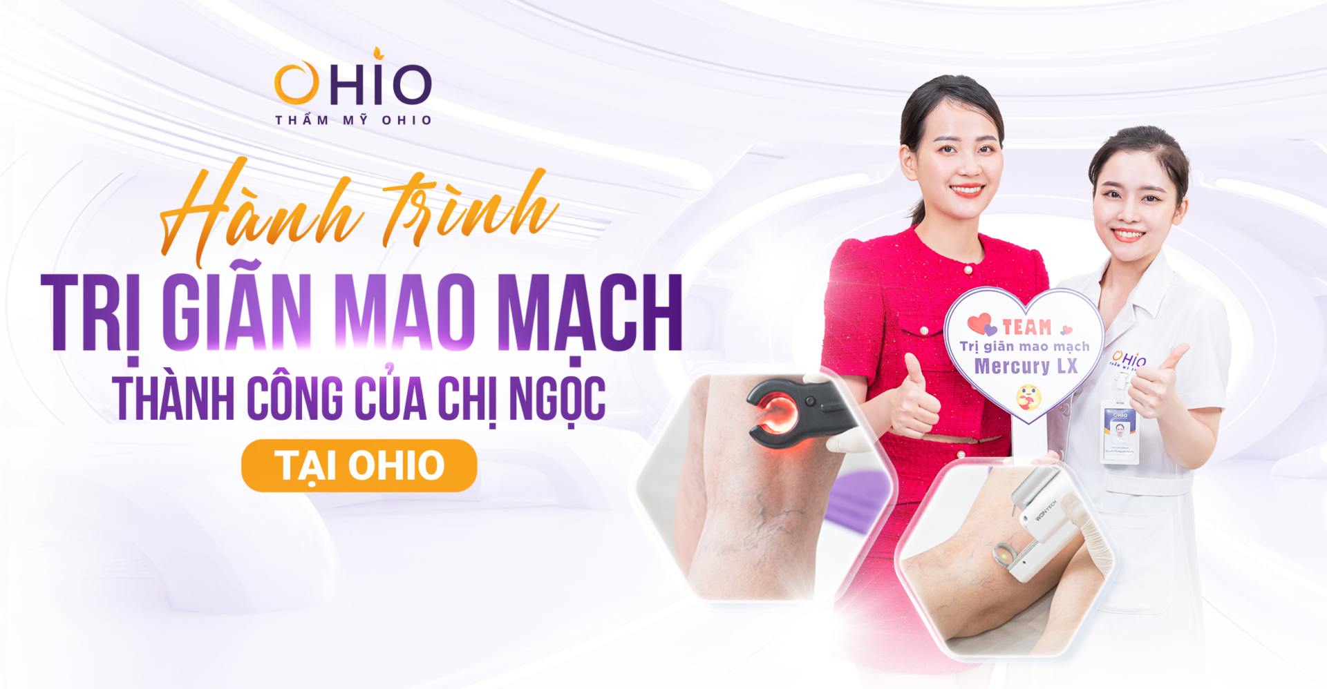 Bí quyết lấy lại đôi chân mất thẩm mỹ vì Giãn mao mạch của cô MC xinh đẹp