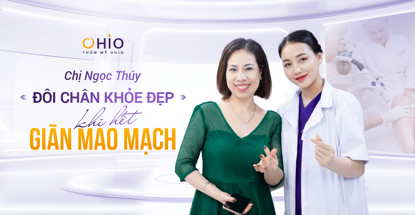 Chị Ngọc Thúy: Đôi chân khỏe đẹp – khi hết giãn mao mạch