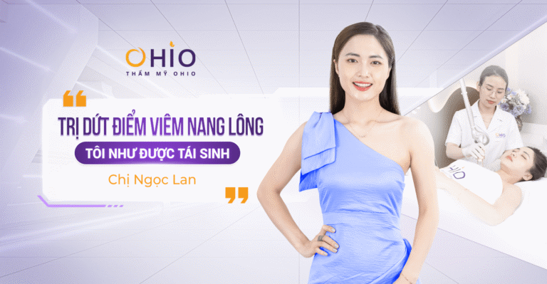 Chị Ngọc Lan: Dứt điểm bệnh viêm nang lông nhờ Matrixlight
