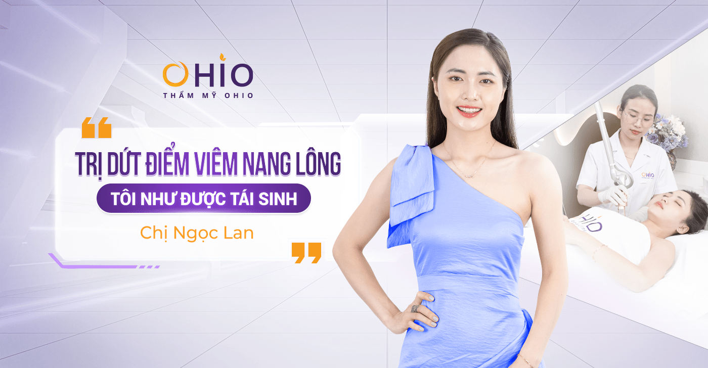 Chị Ngọc Lan: Dứt điểm bệnh viêm nang lông nhờ Matrixlight