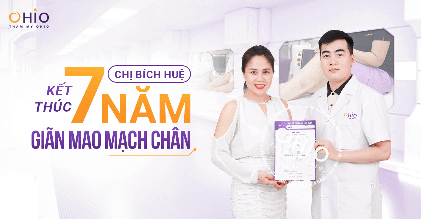 Giãn mao mạch chân 7 năm và “liều thuốc” cứu cánh