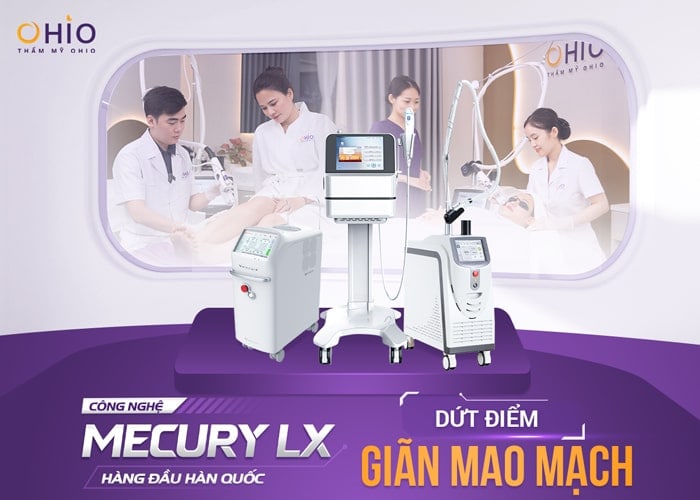 Trị giãn mao mạch hiệu quả với laser xung dài tại Phòng khám chuyên khoa da liễu OHIO