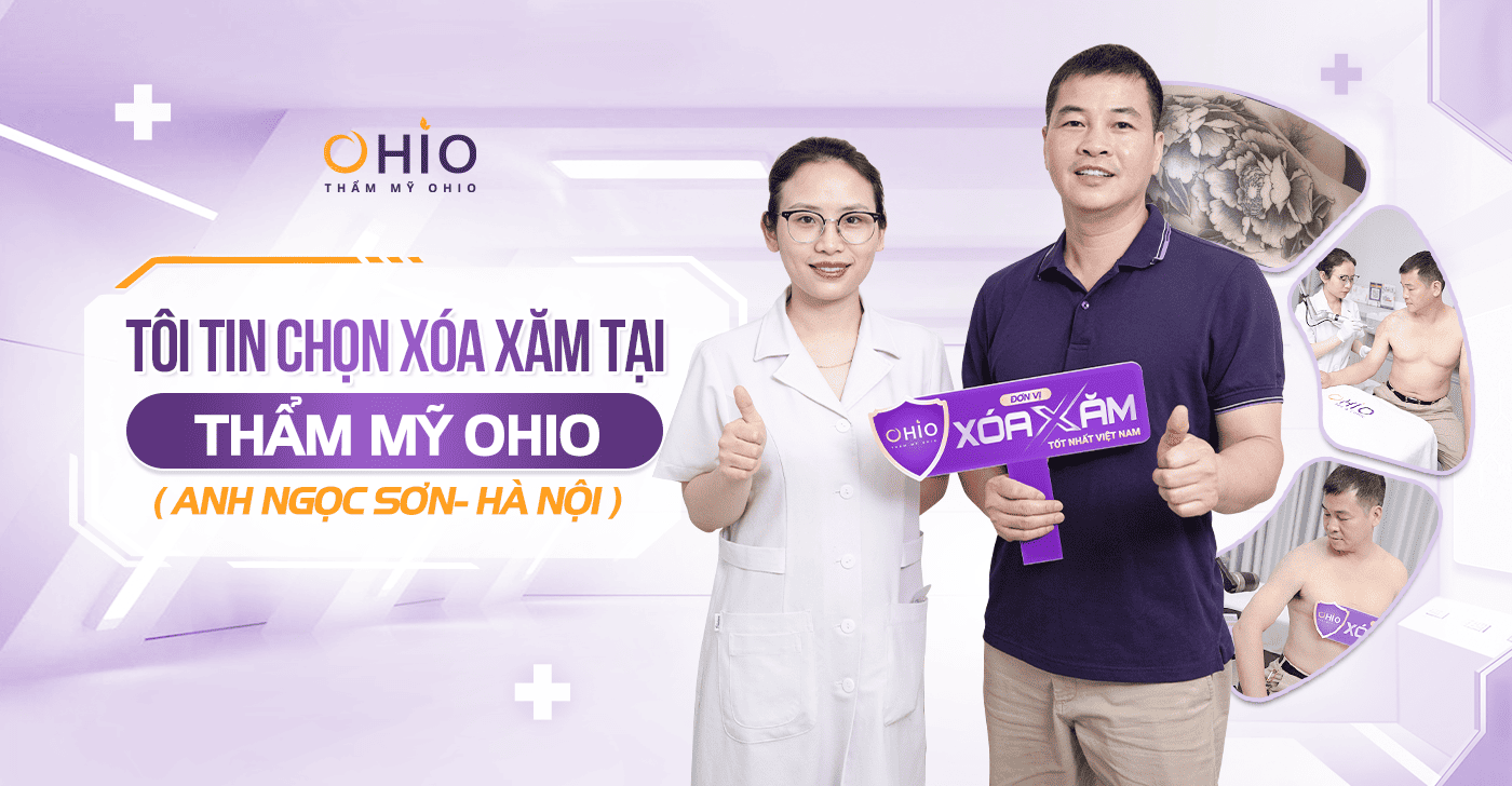 Anh Ngọc Sơn – Thẩm mỹ OHIO đã giúp tôi xóa sạch hình xăm lâu năm!