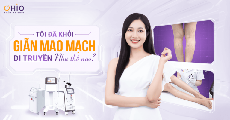 Chị Thùy Dương: Tôi đã khỏi Giãn Mao Mạch di truyền như thế nào?