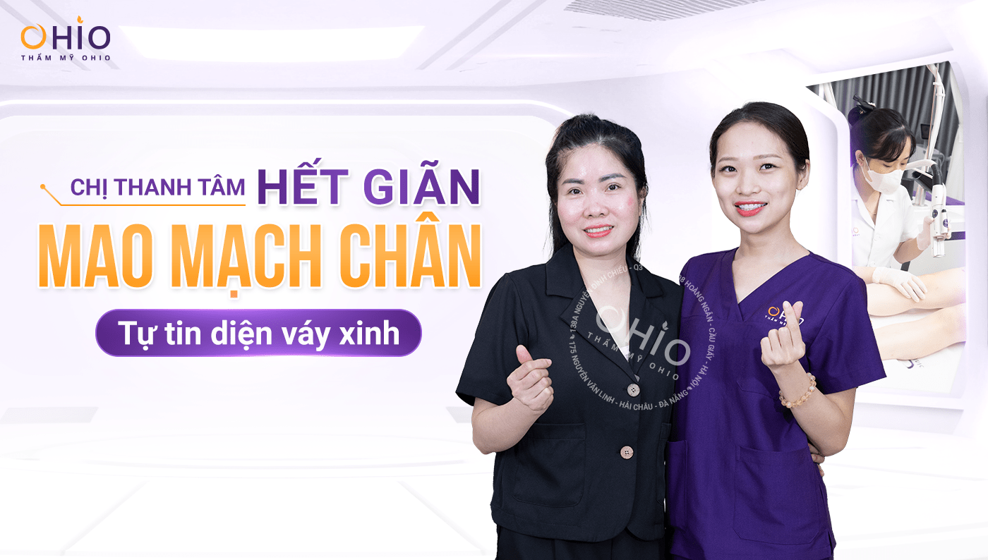 Chị Thanh Tâm: Hết giãn mao mạch chân – tự tin diện váy xinh