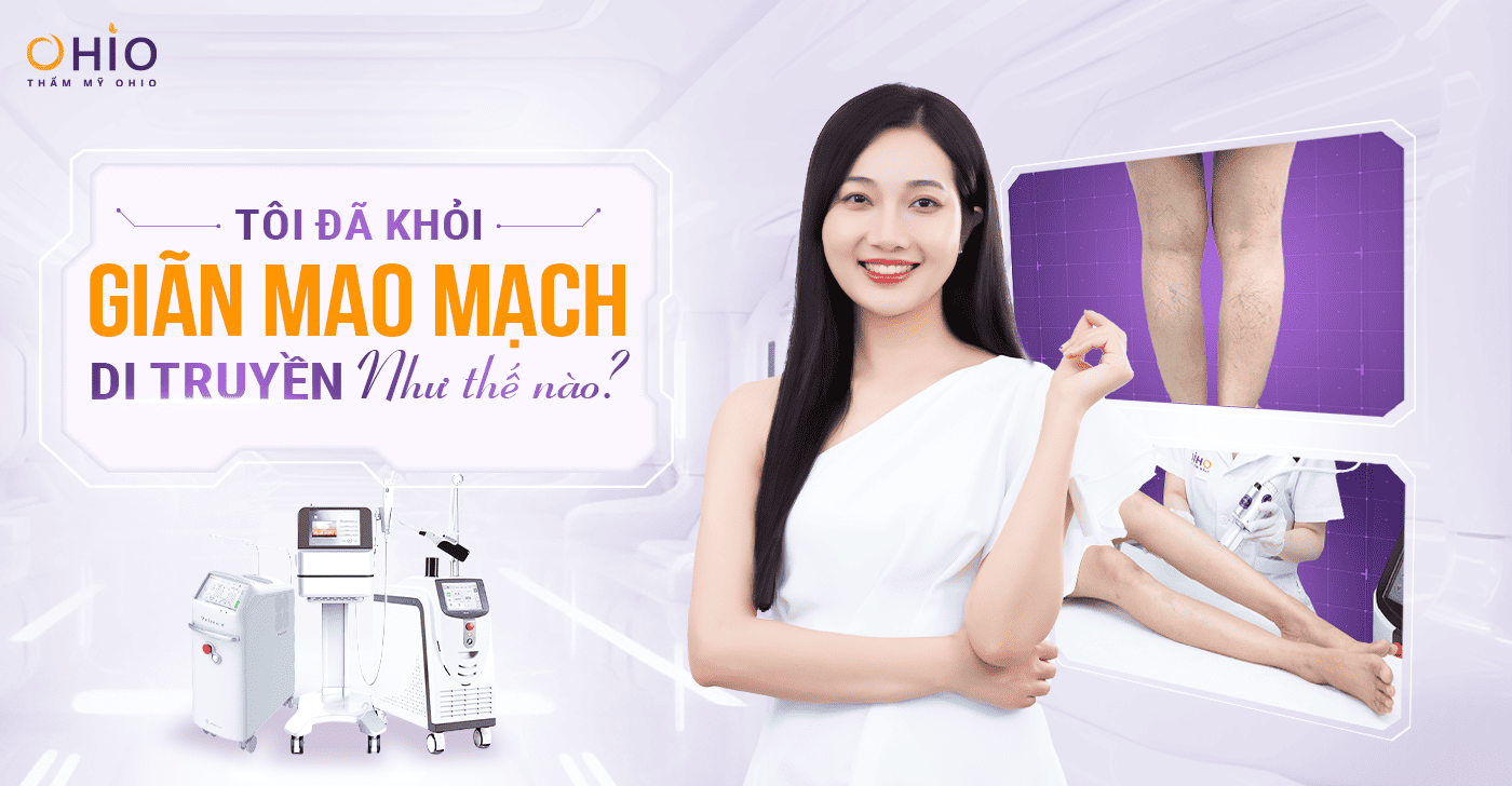 Chị Thùy Dương: Tôi đã khỏi Giãn Mao Mạch di truyền như thế nào?