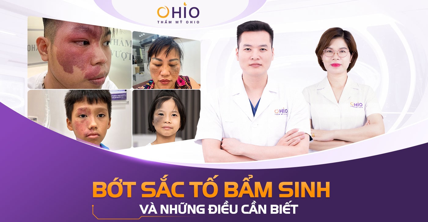 Bớt sắc tố bẩm sinh: Những điều cần biết và cách điều trị an toàn, hiệu quả