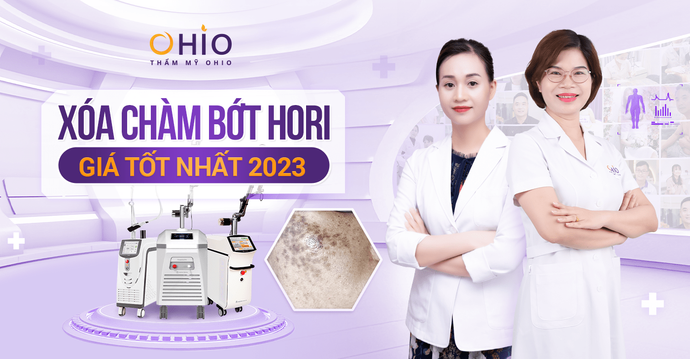 Phương pháp xóa chàm bớt Hori giá bao nhiêu tại Phòng khám OHIO?