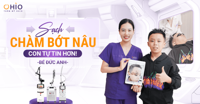 Điều trị vết thâm sạm trên da - Phòng khám da liễu OHIO Gia đình Đức Anh: Lựa chọn xóa chàm cho con tại OHIO là sáng suốt!