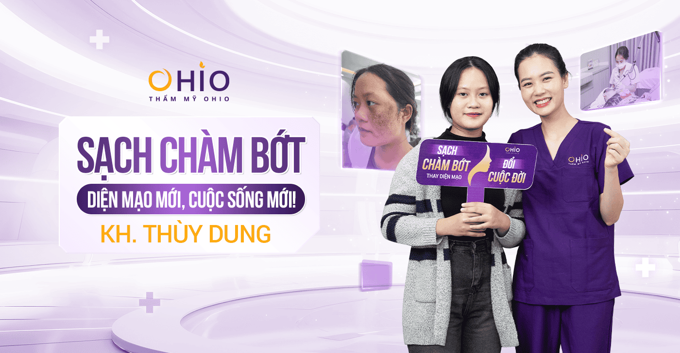 Thùy Dung: Xóa sạch chàm bớt, tương lai rộng mở