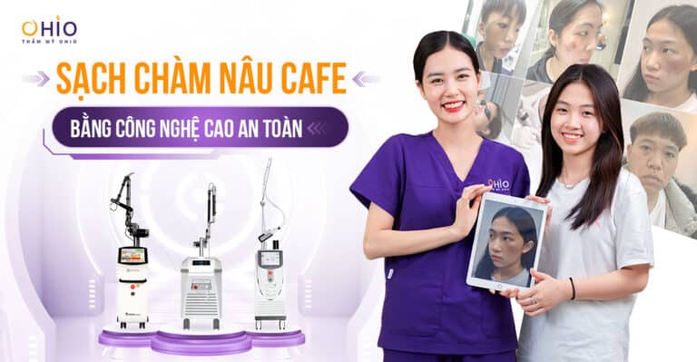 Xóa sạch chàm bớt nâu cafe bằng công nghệ cao Tại Thẩm Mỹ OHIO