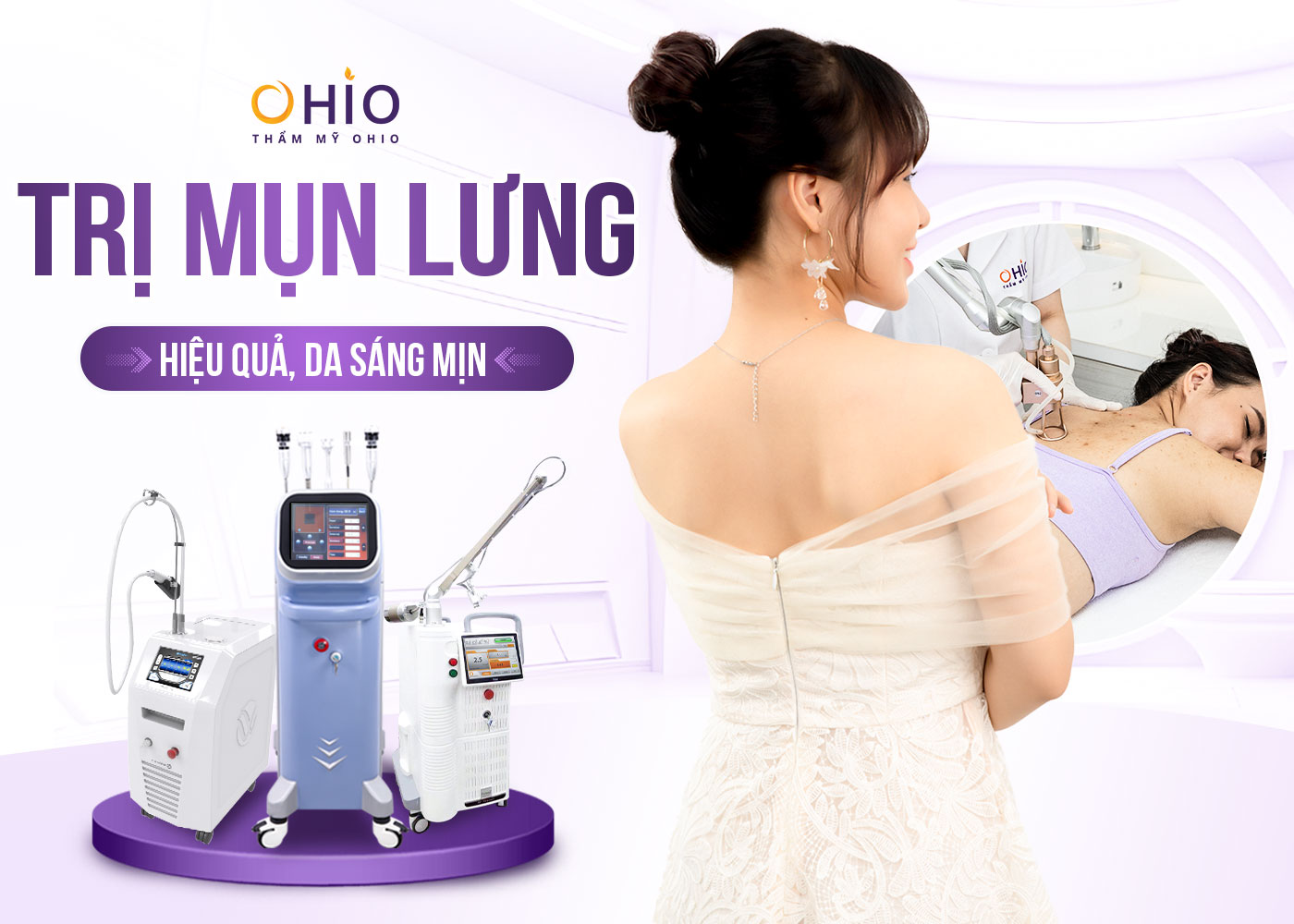 Cách trị mụn lưng an toàn, hiệu quả