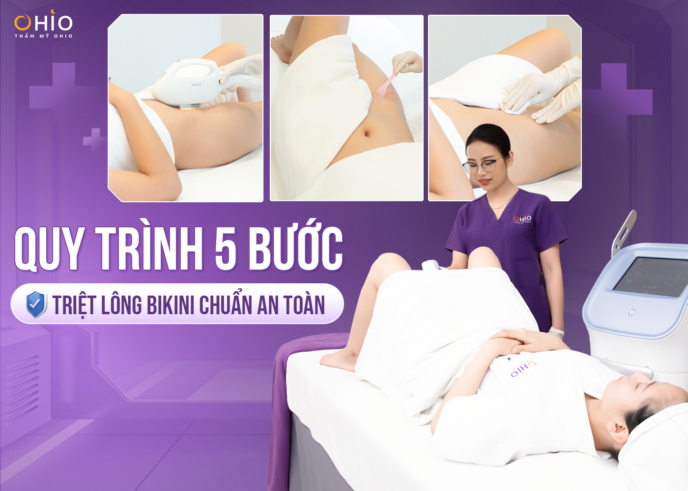 Triệt lông bikini với công nghệ Diode Laser AI tại Phòng khám OHIO