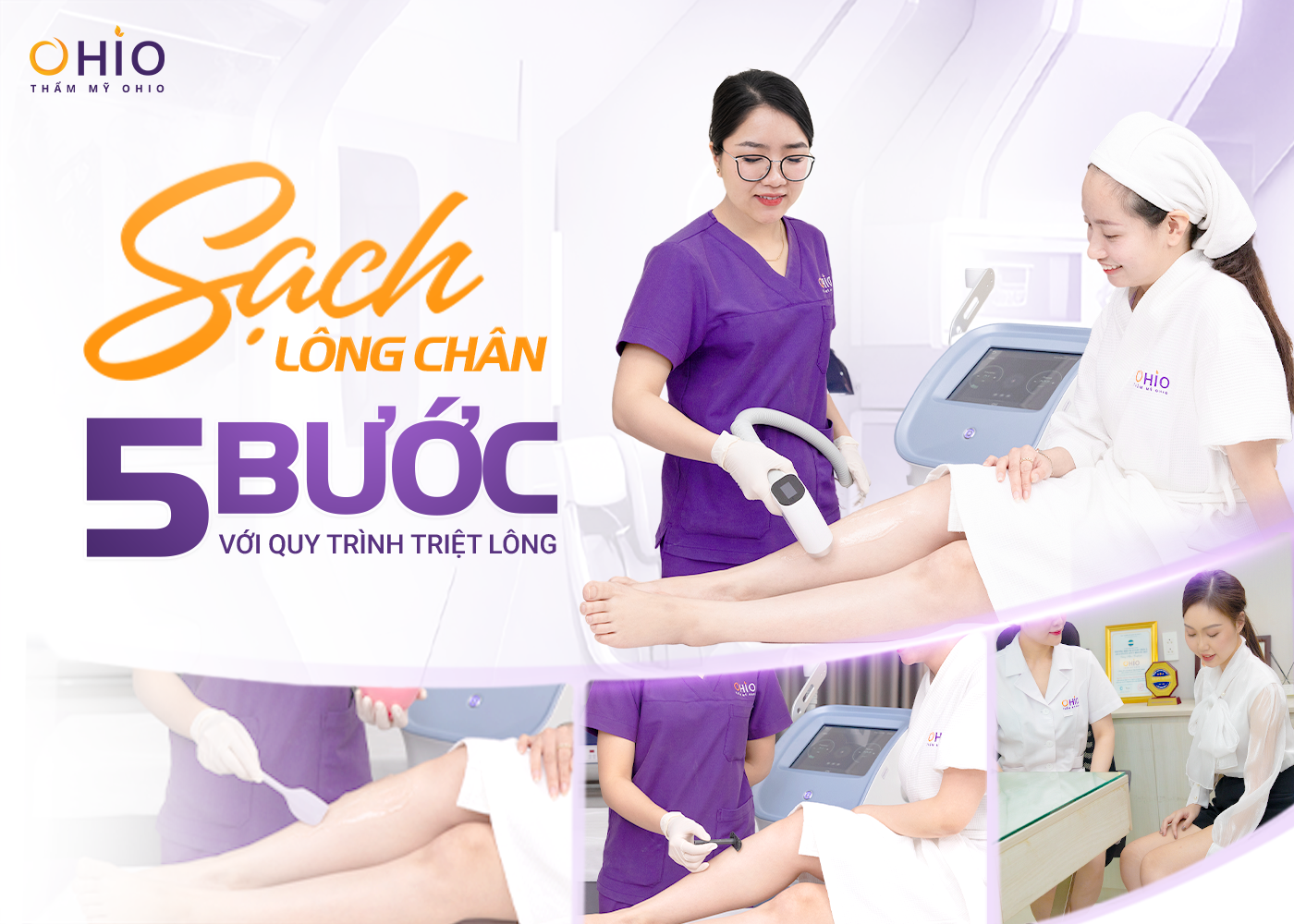 Có nên triệt lông chân bằng công nghệ Diode Laser AI
