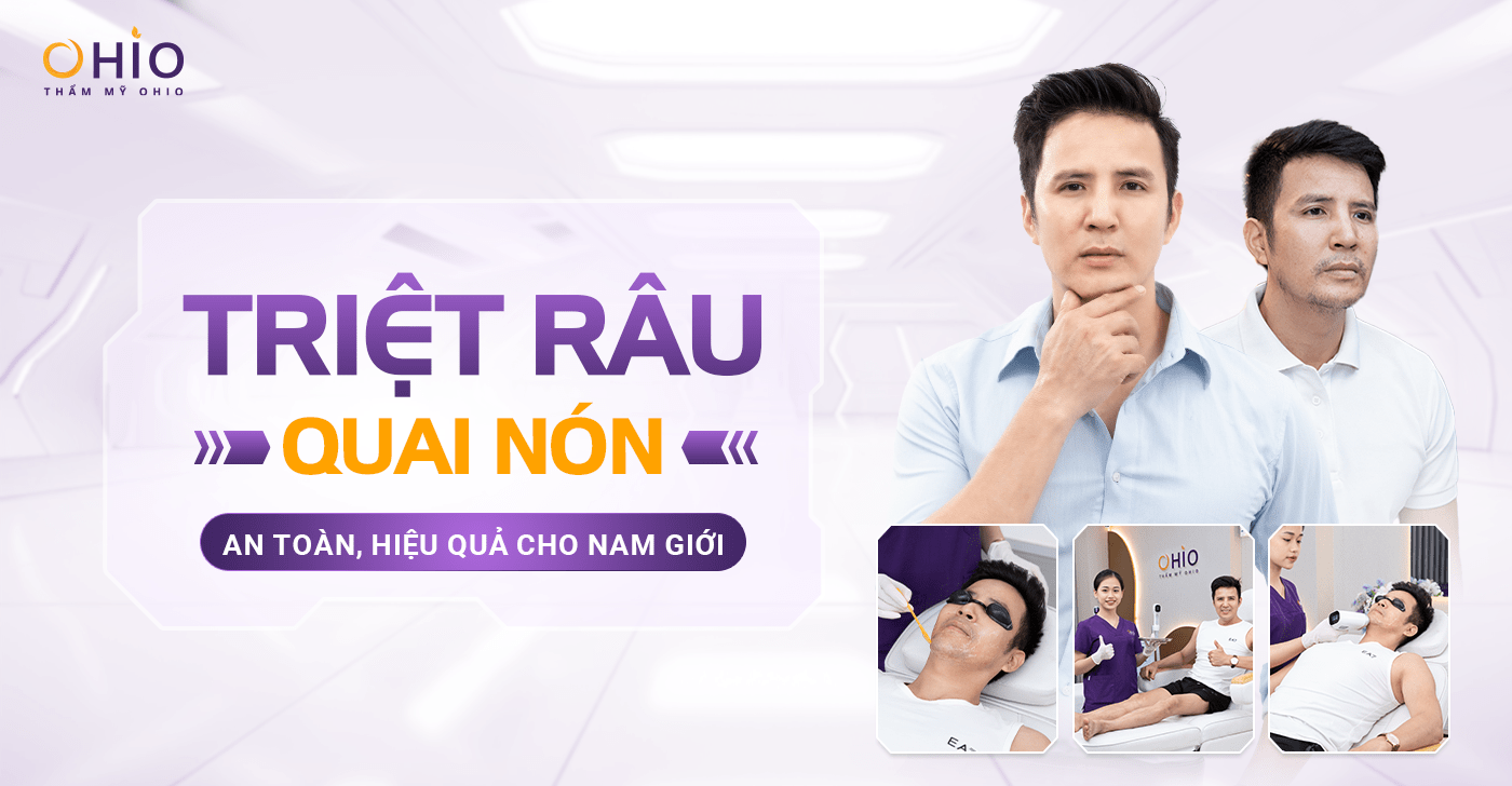 Triệt râu quai nón hiệu quả và những điều nam giới cần biết