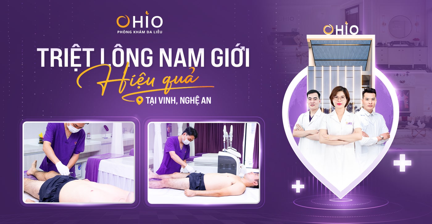Triệt lông cho nam giới hiệu quả tại Vinh, Nghệ An