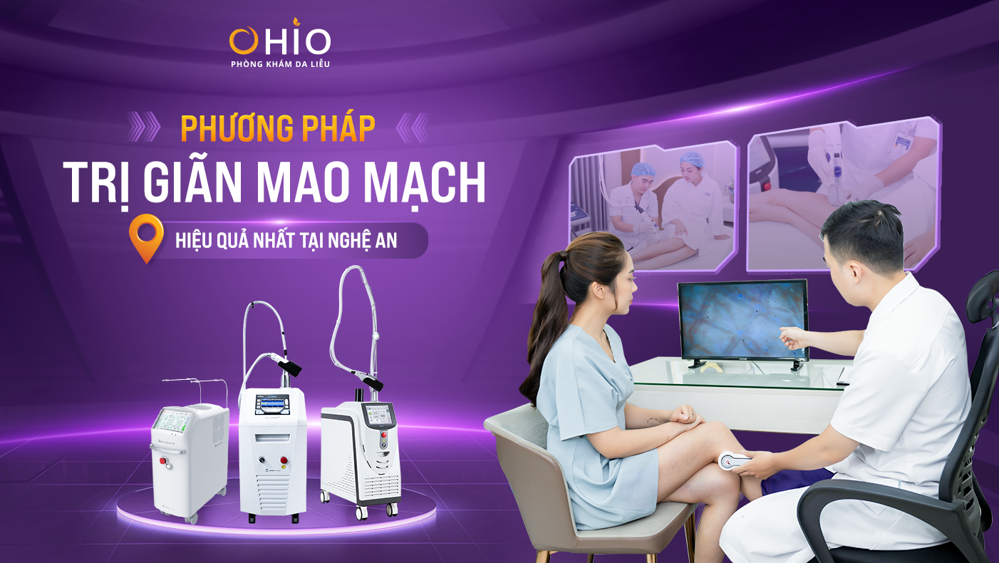 Phương pháp điều trị giãn mao mạch chi dưới hiệu quả  tại Nghệ An