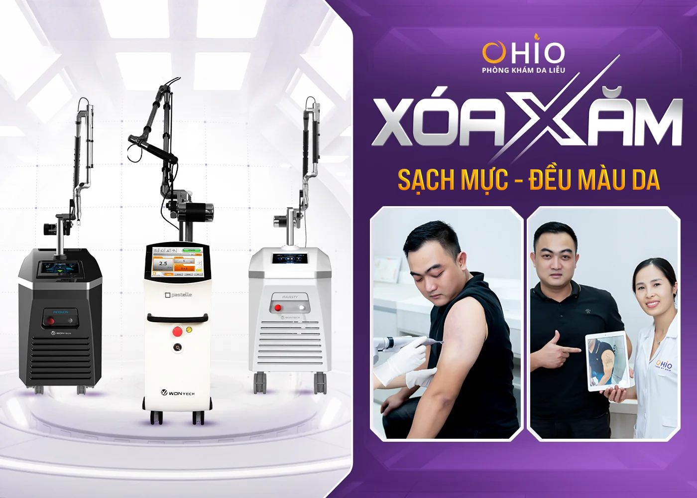 Xóa xăm giá bao nhiêu? Xóa xăm ở đâu thì hiệu quả?