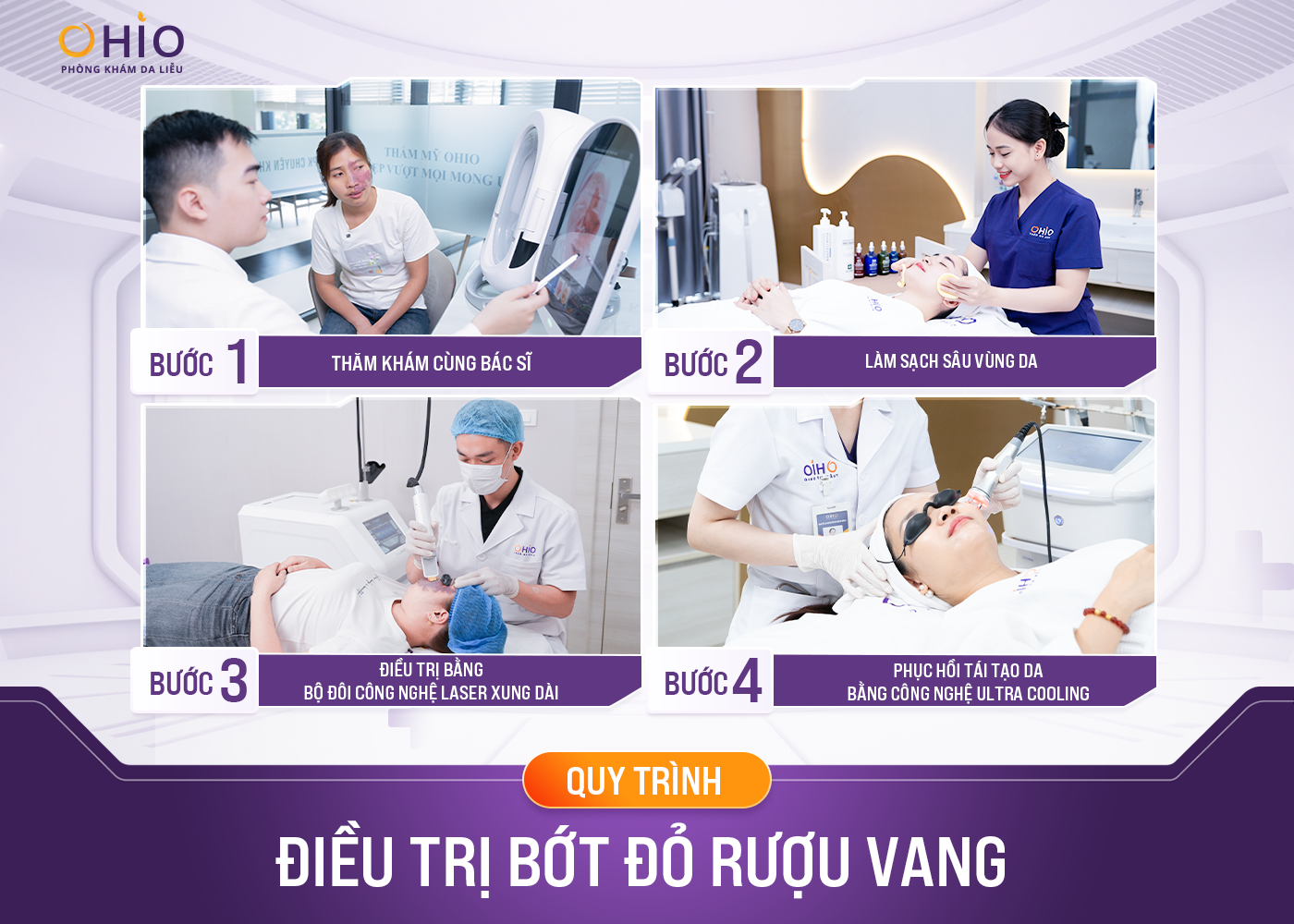 Điều trị chàm bớt đỏ - Phòng khám da liễu OHIO Quy trình điều trị chàm bớt đỏ tại OHIO