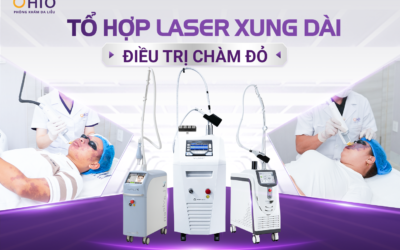 Điều trị chàm bớt đỏ