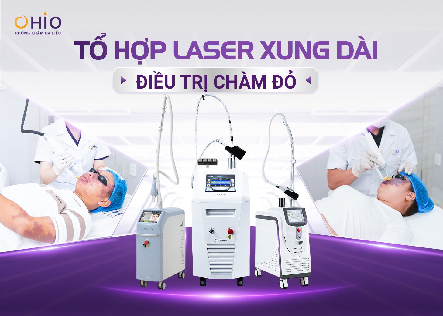 Điều trị chàm bớt đỏ - Phòng khám da liễu OHIO Tổ hợp laser xung dài điều trị chàm bớt đỏ tại OHIO